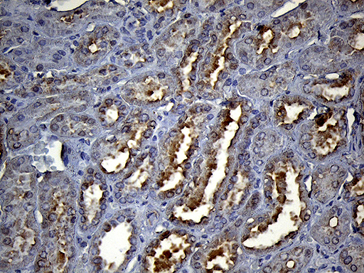 Immunohistochemical staining of paraffin-embedded Human Kidney tissue within the normal limits using anti-HS1BP3 mouse monoclonal antibody