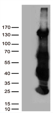 HEK293T cells were transfected with the pCMV6-ENTRY control (Left lane) or pCMV6-ENTRY HS1BP3 (Right lane) cDNA for 48 hrs and lysed
