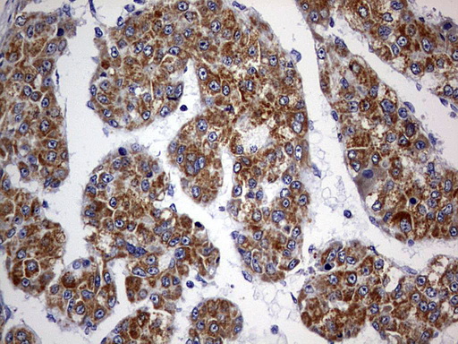 m12866 anti oxsm mouse monoclonal antibody clone id oti4e10 ihc testing 5