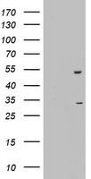 HEK293T cells were transfected with the pCMV6-ENTRY control (Left lane) or pCMV6-ENTRY OXSM (Right lane) cDNA for 48 hrs and lysed