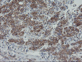 m12929 anti mrps27 mouse monoclonal antibody clone id oti6e5 ihc testing 12