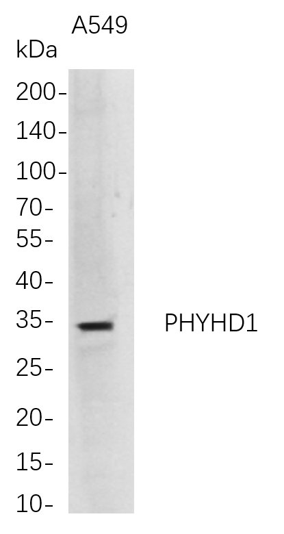 Western Blot analysis of A549 whole cell lysates were separated by 4-20% SDS-PAGE, and the membrane was blotted with anti-PHYHD1 rabbit mAb