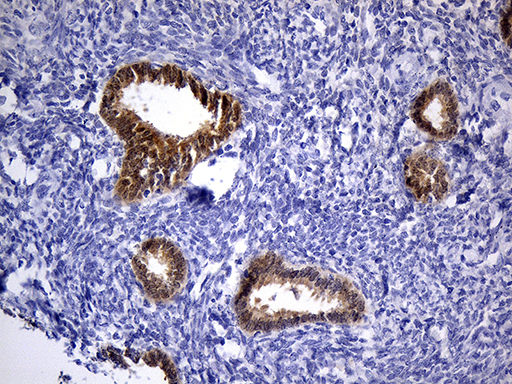 Immunohistochemical staining of paraffin-embedded Human endometrium tissue within the normal limits using anti-PHYHD1 mouse monoclonal antibody