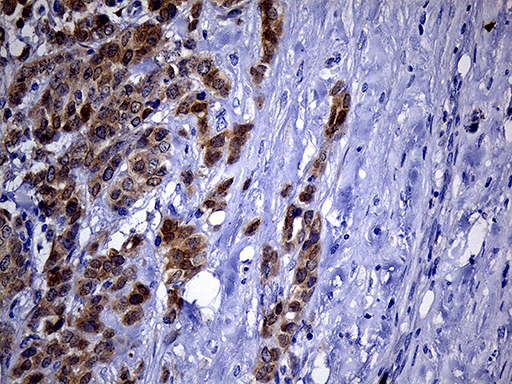 m12964 anti phyhd1 mouse monoclonal antibody clone id oti1a6 ihc testing 4