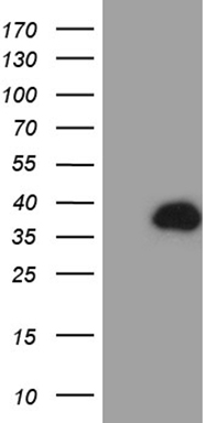 HEK293T cells were transfected with the pCMV6-ENTRY control (Left lane) or pCMV6-ENTRY PHYHD1 (Right lane) cDNA for 48 hrs and lysed