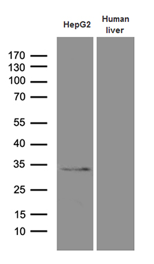 Western blot analysis of extracts (35ug) from Hepg2 cell line and human liver tissue lysate by using anti-PHYHD1 monoclonal antibody (1:500)