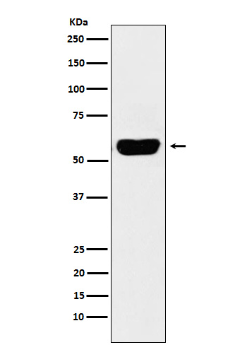 Western blot analysis of Salivary alpha amylase expression in Human pancreas lysate