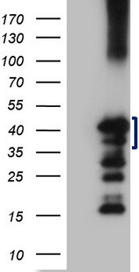 HEK293T cells were transfected with the pCMV6-ENTRY control (Left lane) or pCMV6-ENTRY ZC3H8 (Right lane) cDNA for 48 hrs and lysed