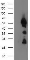 m12989 anti ubxn2b mouse monoclonal antibody clone id oti1f7 wb testing 1