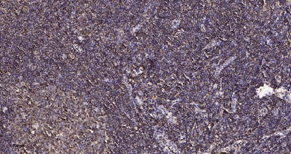 m12995 1 gcsam primary antibodies ihc testing 1