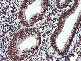 Immunohistochemical staining of paraffin-embedded Human endometrium tissue within the normal limits using anti-OSGEP mouse monoclonal antibody