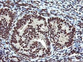 m13000 1 anti osgep mouse monoclonal antibody clone id oti9e3 ihc testing 4