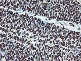 m13000 1 anti osgep mouse monoclonal antibody clone id oti9e3 ihc testing 6
