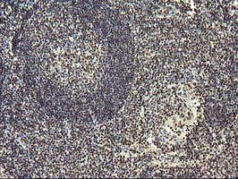 m13000 1 anti osgep mouse monoclonal antibody clone id oti9e3 ihc testing 7