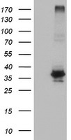 HEK293T cells were transfected with the pCMV6-ENTRY control (Left lane) or pCMV6-ENTRY OSGEP (Right lane) cDNA for 48 hrs and lysed