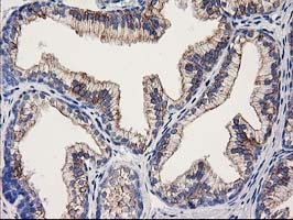 Immunohistochemical staining of paraffin-embedded Human prostate tissue within the normal limits using anti-OSGEP mouse monoclonal antibody