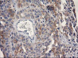 m13000 anti osgep mouse monoclonal antibody clone id oti8b3 ihc testing 4