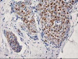 m13000 anti osgep mouse monoclonal antibody clone id oti8b3 ihc testing 5