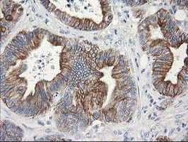 m13000 anti osgep mouse monoclonal antibody clone id oti8b3 ihc testing 6