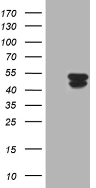 m13044 anti krt31 mouse monoclonal antibody clone id oti2c3 wb testing 1