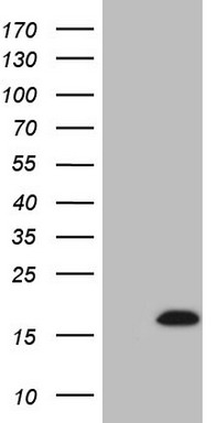 HEK293T cells were transfected with the pCMV6-ENTRY control (Left lane) or pCMV6-ENTRY UBL3 (Right lane) cDNA for 48 hrs and lysed
