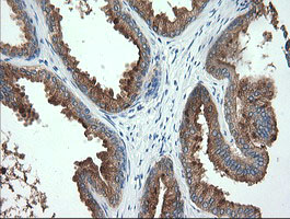 Immunohistochemical staining of paraffin-embedded Human prostate tissue within the normal limits using anti-TMPRSS5 mouse monoclonal antibody