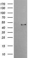HEK293T cells were transfected with the pCMV6-ENTRY control (Left lane) or pCMV6-ENTRY TMPRSS5 (Right lane) cDNA for 48 hrs and lysed