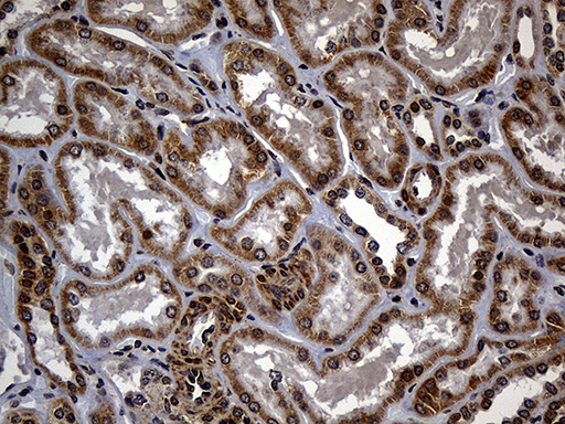 m13064 anti c9orf89 card19 mouse monoclonal antibody clone id oti4e10 ihc testing 2