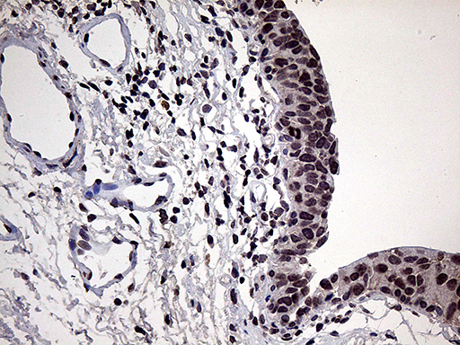 Immunohistochemical staining of paraffin-embedded Human bladder tissue within the normal limits using anti-POLR3H mouse monoclonal antibody