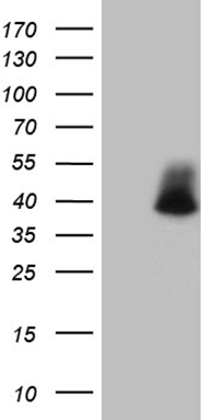 HEK293T cells were transfected with the pCMV6-ENTRY control (Left lane) or pCMV6-ENTRY POLR3H (Right lane) cDNA for 48 hrs and lysed