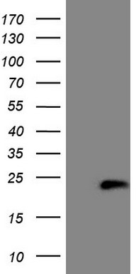 HEK293T cells were transfected with the pCMV6-ENTRY control (Left lane) or pCMV6-ENTRY HPCAL4 (Right lane) cDNA for 48 hrs and lysed. Equivalent amounts of cell lysates (5 ug per lane) were separated by SDS-PAGE and immunoblotted with anti-HPCAL4 (1:2000).
