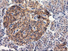 m13135 anti rtn4ip1 mouse monoclonal antibody clone id oti3b2 ihc testing 2