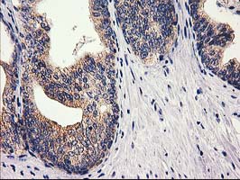 m13135 anti rtn4ip1 mouse monoclonal antibody clone id oti3b2 ihc testing 3