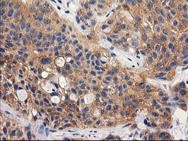 m13135 anti rtn4ip1 mouse monoclonal antibody clone id oti3b2 ihc testing 4