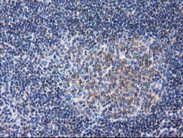m13135 anti rtn4ip1 mouse monoclonal antibody clone id oti3b2 ihc testing 5