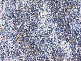 m13135 anti rtn4ip1 mouse monoclonal antibody clone id oti3b2 ihc testing 6