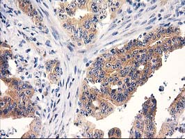 m13135 anti rtn4ip1 mouse monoclonal antibody clone id oti3b2 ihc testing 7