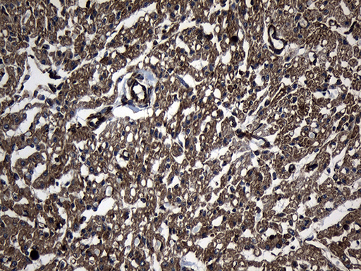 Immunohistochemical staining of paraffin-embedded Human adult heart tissue within the normal limits using anti-UBE2D4 mouse monoclonal antibody