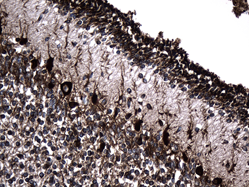 Immunohistochemical staining of paraffin-embedded Human embryonic cerebellum within the normal limits using anti-UBE2D4 mouse monoclonal antibody