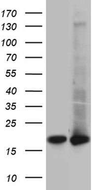 HEK293T cells were transfected with the pCMV6-ENTRY control (Left lane) or pCMV6-ENTRY UBE2D4 (Right lane) cDNA for 48 hrs and lysed