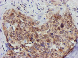 m13227 anti fbxo21 mouse monoclonal antibody clone id oti5h4 ihc testing 11