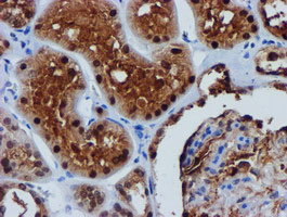 m13227 anti fbxo21 mouse monoclonal antibody clone id oti5h4 ihc testing 12