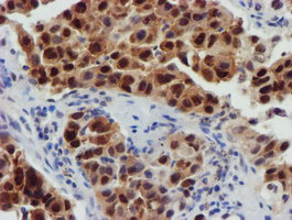 m13227 anti fbxo21 mouse monoclonal antibody clone id oti5h4 ihc testing 3