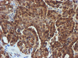m13227 anti fbxo21 mouse monoclonal antibody clone id oti5h4 ihc testing 4