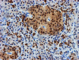 m13227 anti fbxo21 mouse monoclonal antibody clone id oti5h4 ihc testing 5