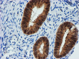 m13227 anti fbxo21 mouse monoclonal antibody clone id oti5h4 ihc testing 6