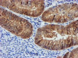 m13227 anti fbxo21 mouse monoclonal antibody clone id oti5h4 ihc testing 7