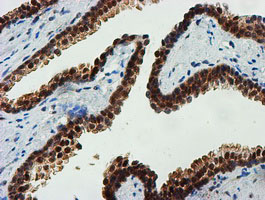 m13227 anti fbxo21 mouse monoclonal antibody clone id oti5h4 ihc testing 8