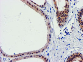 m13227 anti fbxo21 mouse monoclonal antibody clone id oti5h4 ihc testing 9