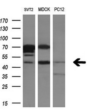 Western blot analysis of extracts (10ug) from 3 different cell lines by using anti-RAB3IL1monoclonal antibody (1:200).